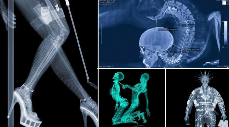 Рентген девушки гимнастки в прогибе и другие фото-приколы с рентгеном |  Пикабу