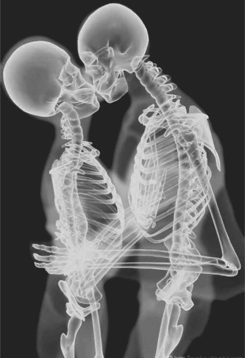 Рентген девушки гимнастки в прогибе и другие фото-приколы с рентгеном |  Пикабу