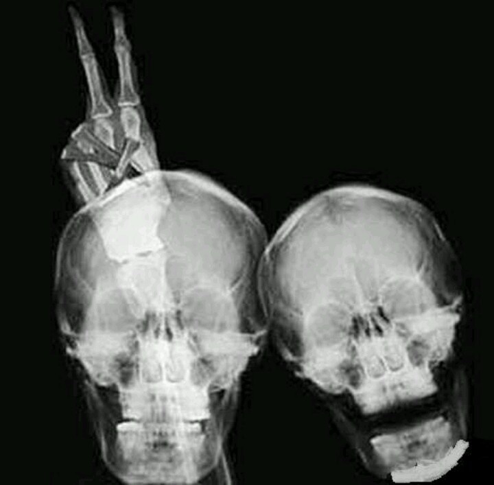Необычные рентгеновские снимки (20 фото)