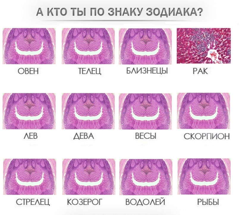 Рак | Пикабу