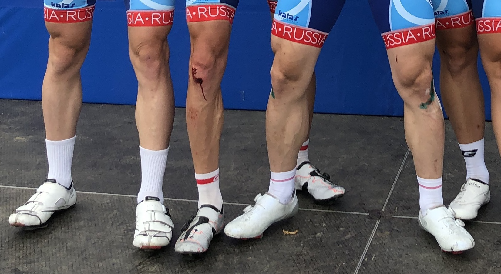 Зачем велогонщики бреют ноги? | Пикабу