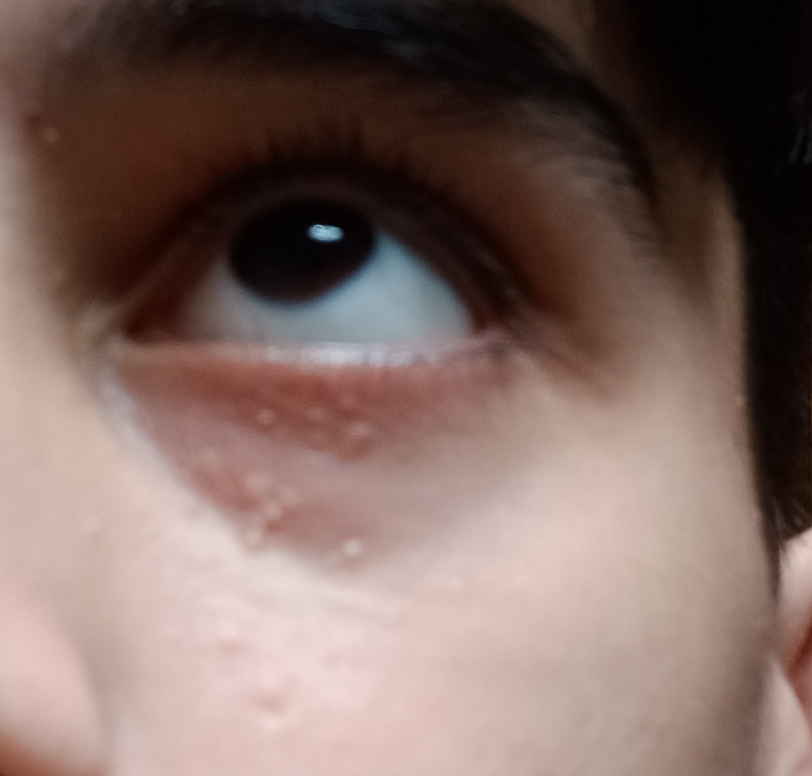Сыпь вокруг глаз: основные причины - витамин-п-байкальский.рф