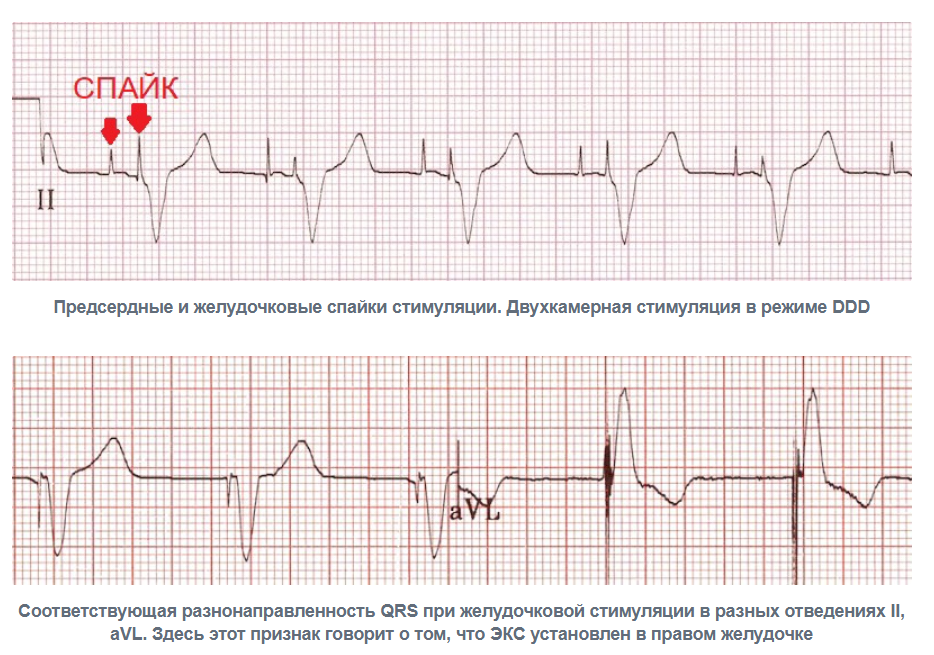 Порно қалыңдық дос