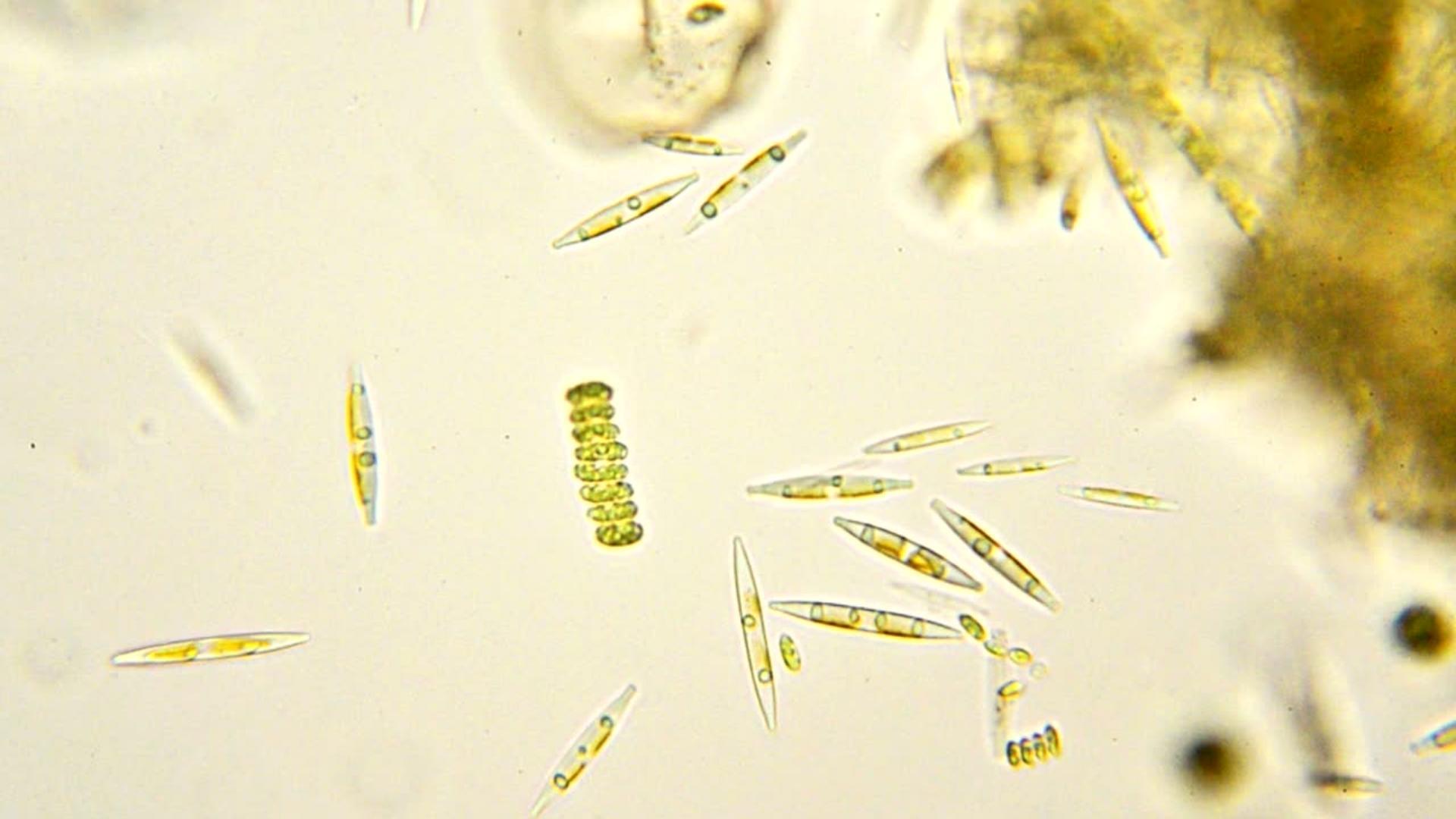 Наглядная микробиология #6 Диатомовые водоросли (Diatom) | Пикабу