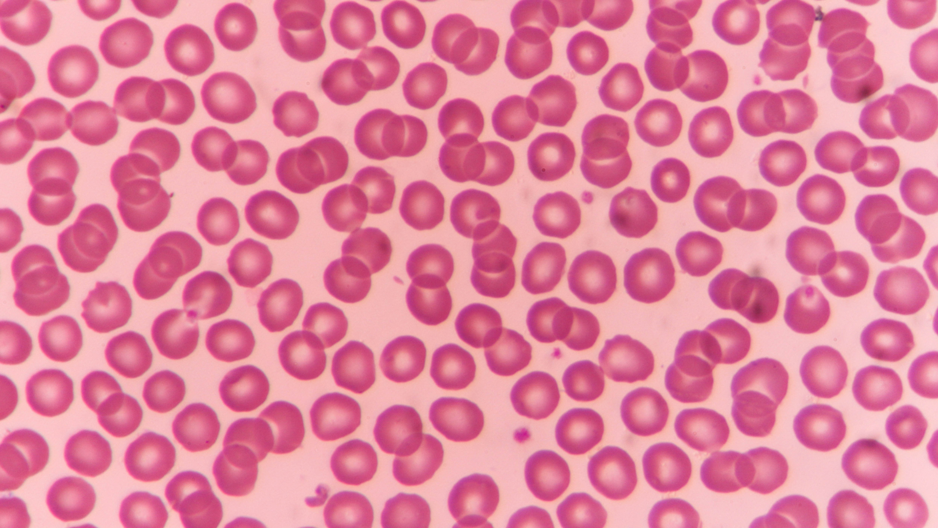 Человеческий организм под микроскопом (17 фото) | Клетки крови, Микроскопы, Стволовые клетки