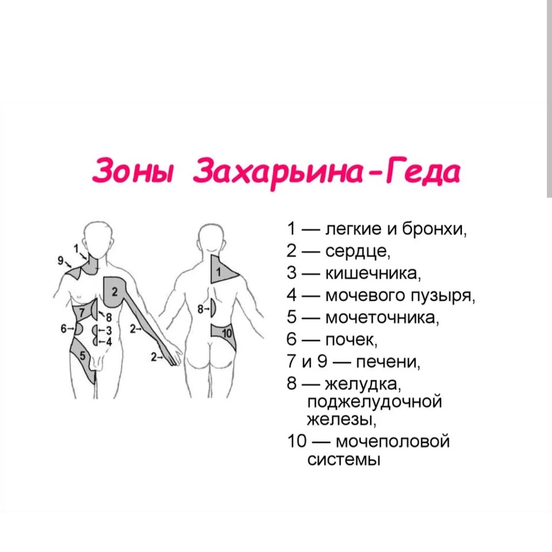 Рефлекторные боли. Зоны кожной гиперестезии Захарьина Геда. Зоны Захарьина-Геда схема. Зоны Захарьина Геда зоны отраженных болей. Кожа зоны Захарьина Геда.