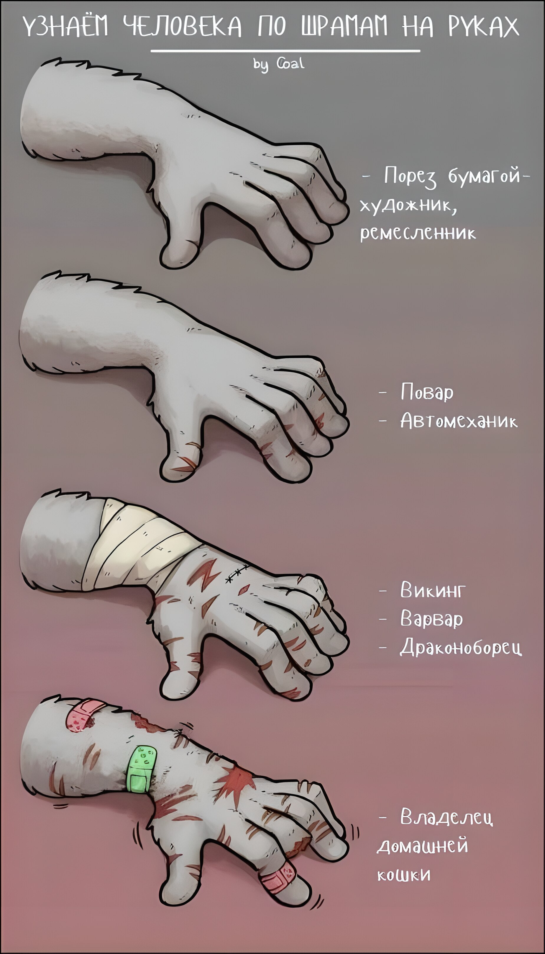 Узнаём человека по шрамам | Пикабу