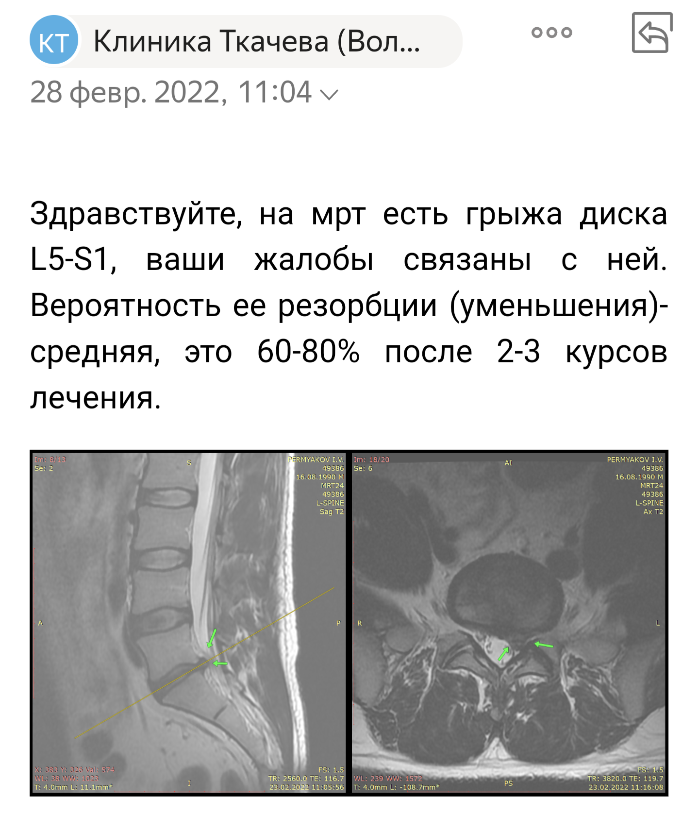 Как я вылечил грыжу без операции | Пикабу