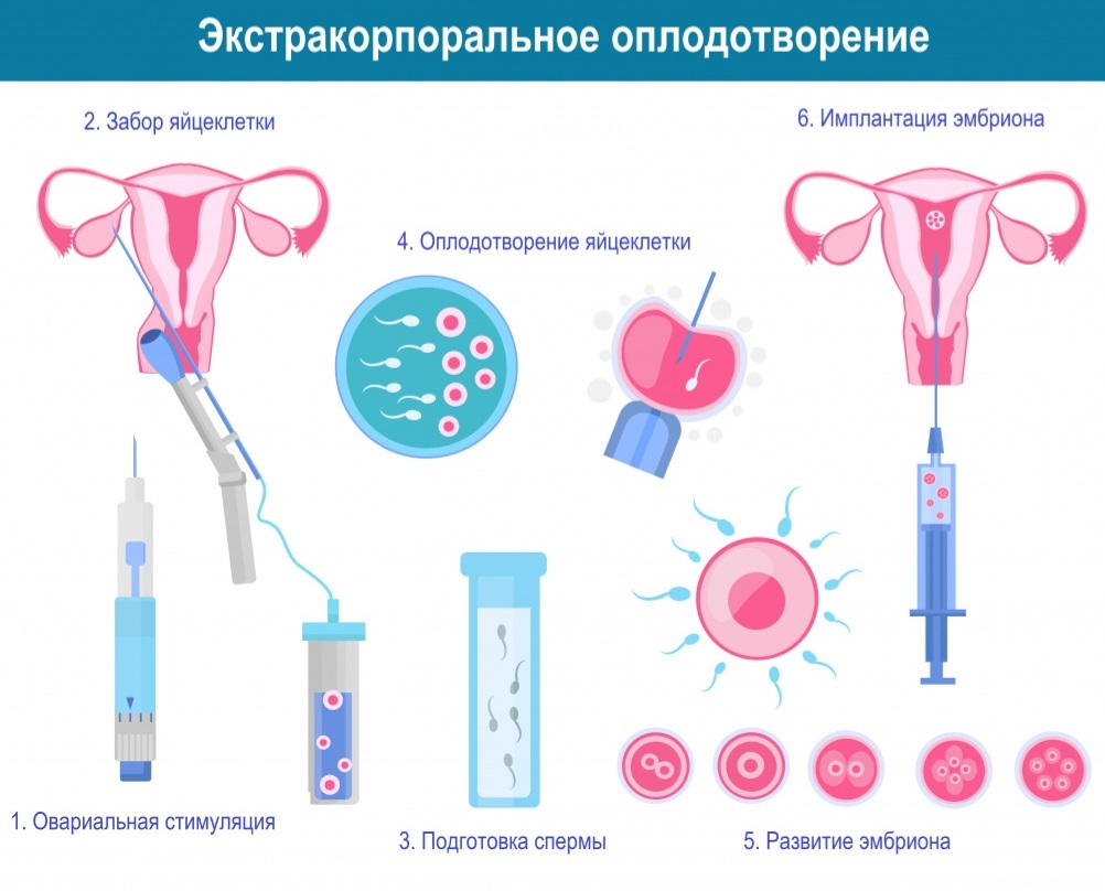 ЭКО. Экстракорпоральное оплодотворение | Пикабу