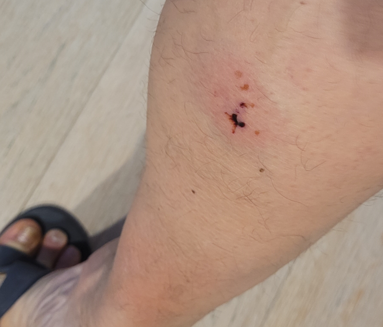 30 тысяч за собачий укус | Пикабу