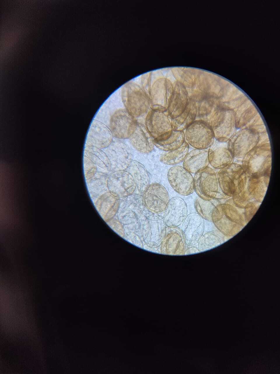 Широкий лентец (Diphyllobothrium latum) | Пикабу