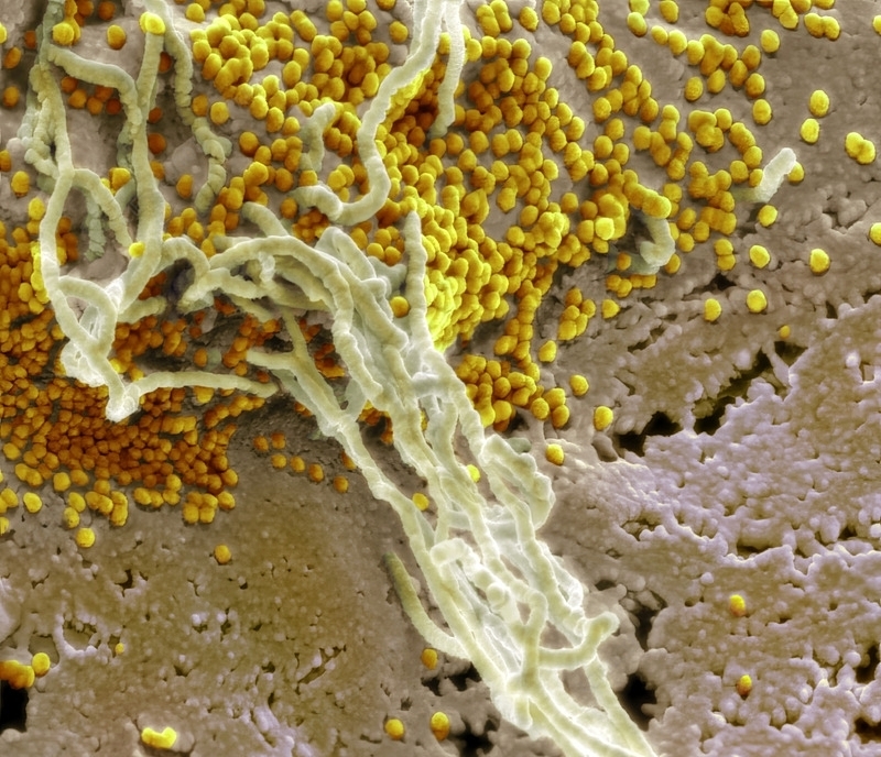 Под микроскопом: пристальный взгляд на самые опасные вирусы мира