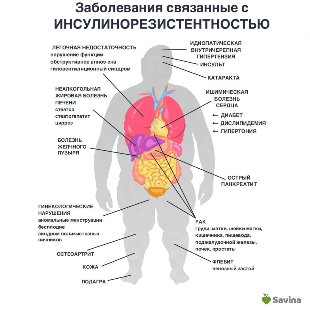 Симптомы и признаки инсулинорезистентности у женщин и мужчин — касается  каждого с лишним весом более 5 кг | Пикабу