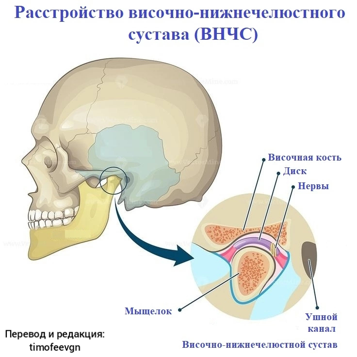 Кости черепа | Пикабу