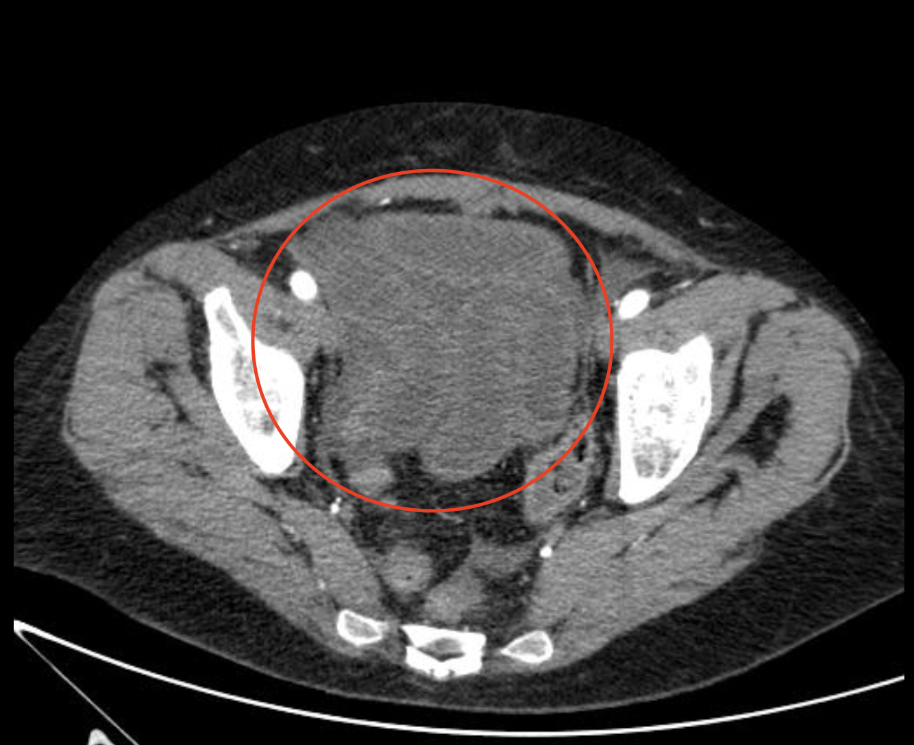 Случаи из практики: заворот кишок | Пикабу
