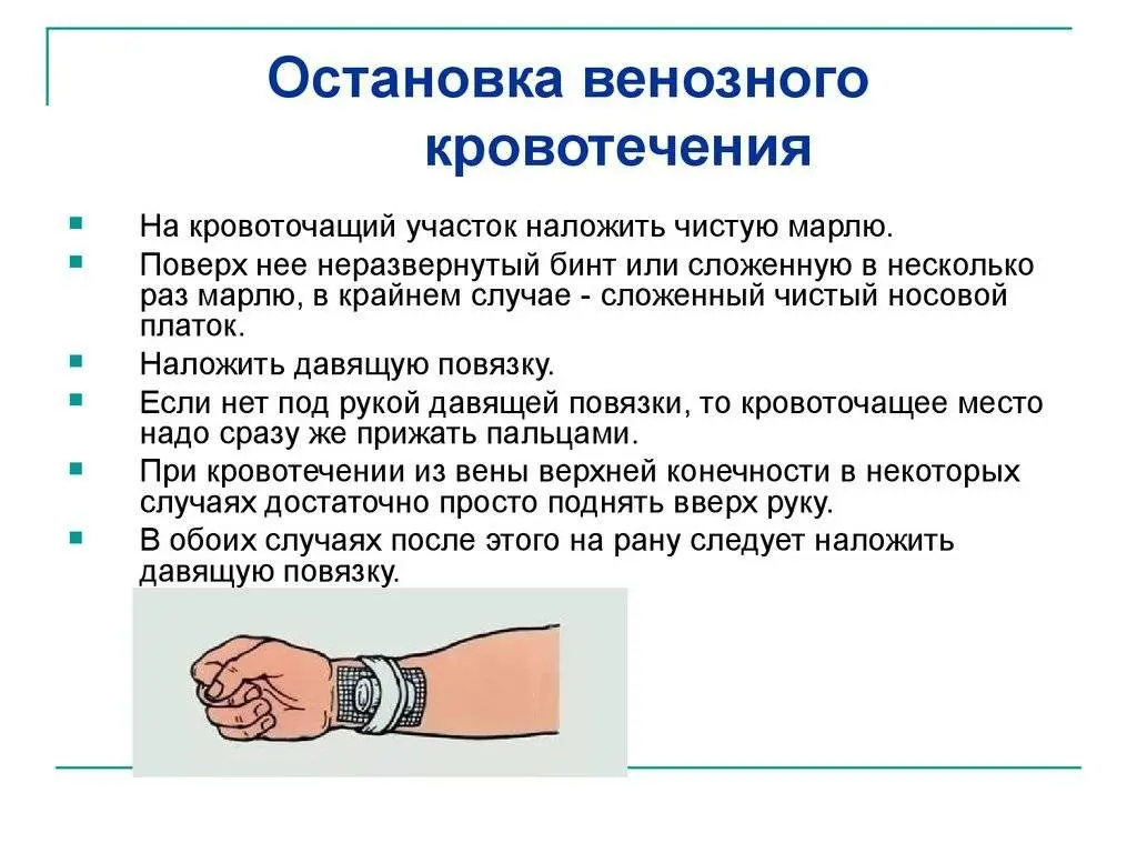 Урок №5 Венозное кровотечение, безопасность и способы остановки (часть  вторая) | Пикабу