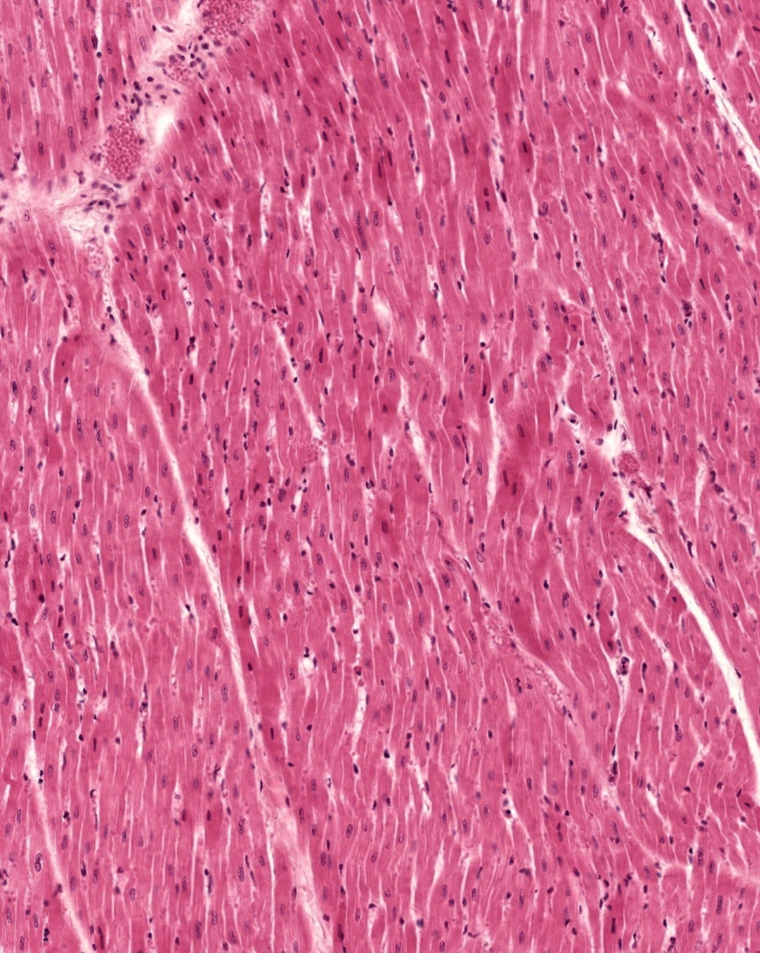 Патологическая анатомия для самых маленьких (выпуск 11) | Пикабу