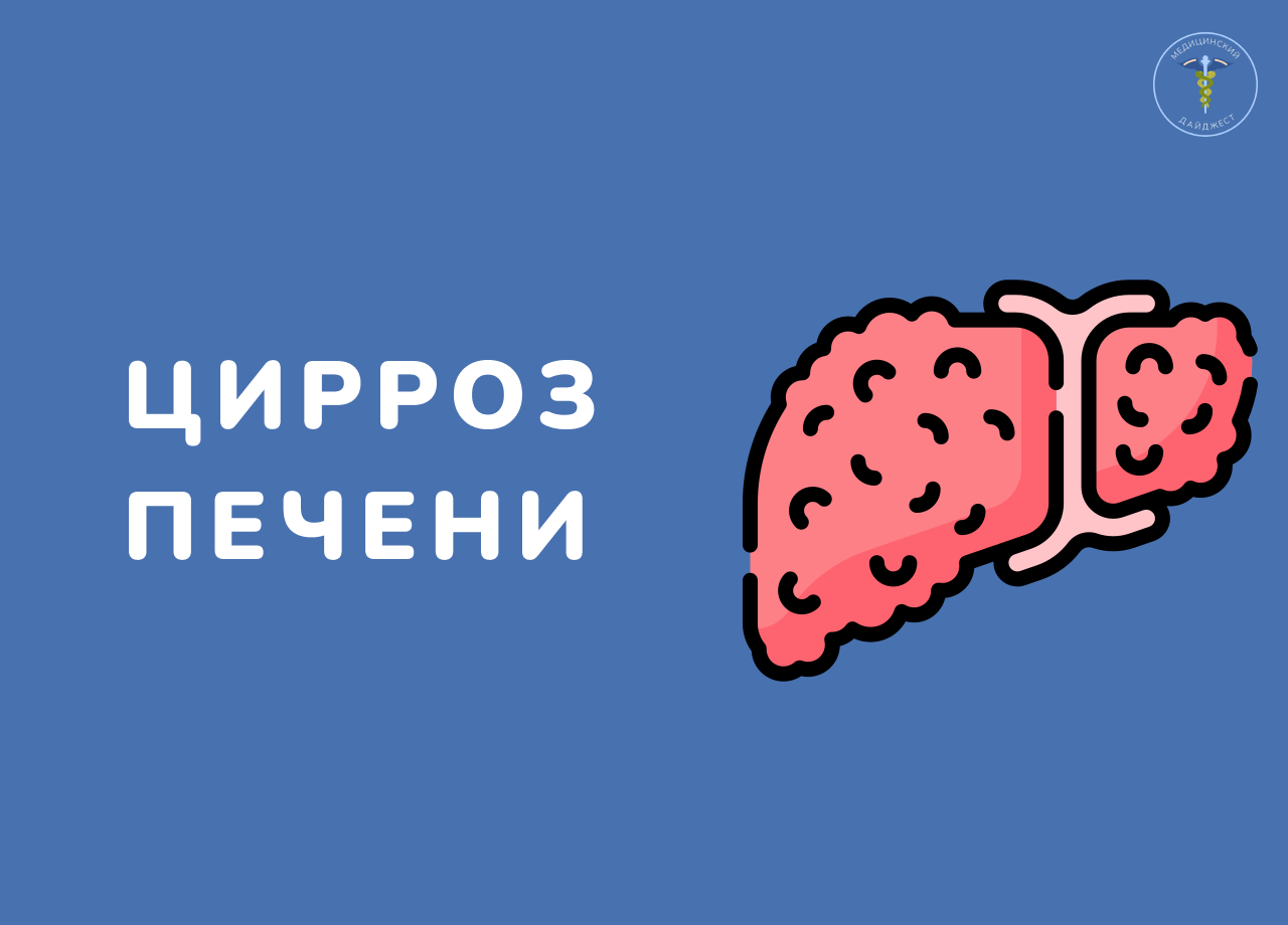 Цирроз печени | Пикабу